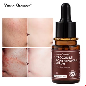 سرم رفع اسکار روغن تمساح 30 میل Vibrant Glamour